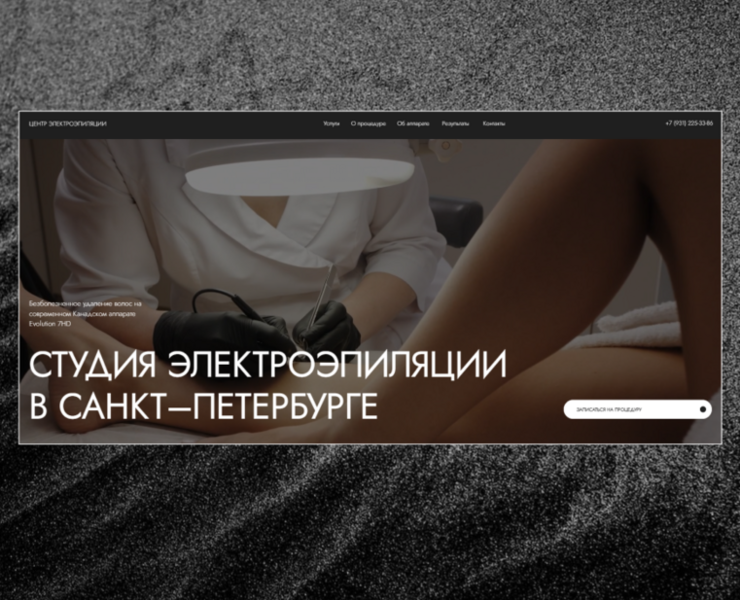 СТУДИЯ ЭЛЕКТРОЭПИЛЯЦИИ